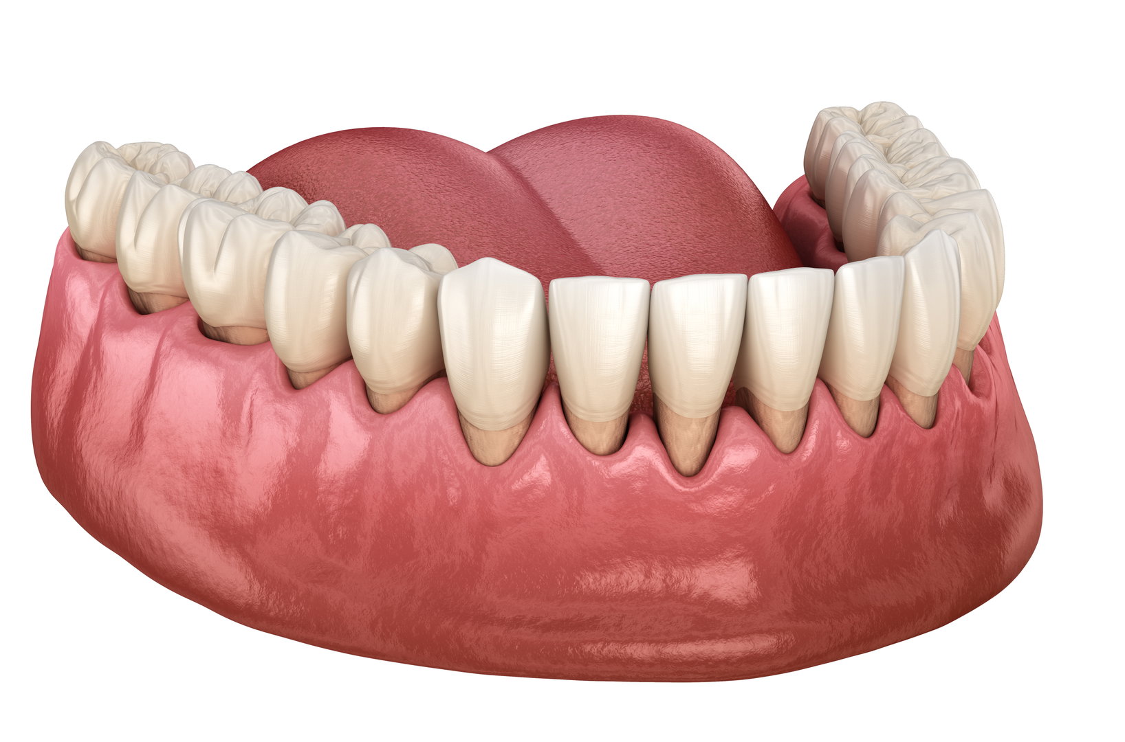 gum-treatment1