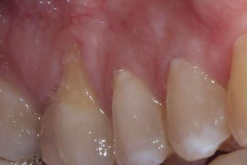 Before Afters